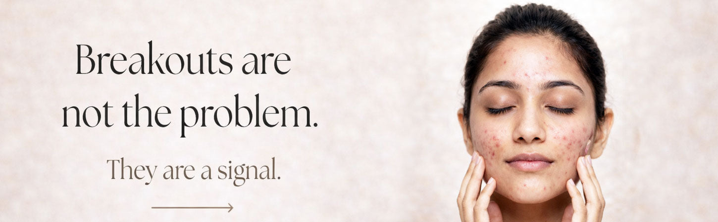 Breakouts Are Not the Problem - They Are a Signal